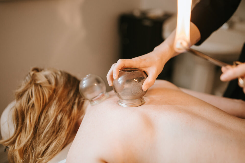 Fire cupping treatment being applied to the back of a client