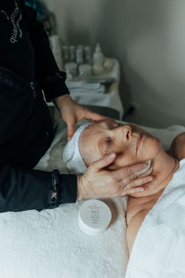 Woman receiving QPeel glycolic facial peel treatment